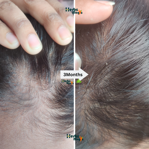 Herbs Magic Ayurvedic Keshavriddhi Hair Oil & Kesh Kalpa Hair Mask | Complete Hair Care combo for increasing Hairfall - Image 2