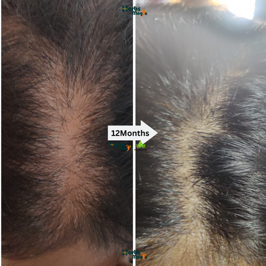 Herbs Magic Keshavriddhi Hair Oil & Kesh Kalpa Hair Mask | Complete Hair Care Duo for increasing Hair Fall - Image 4